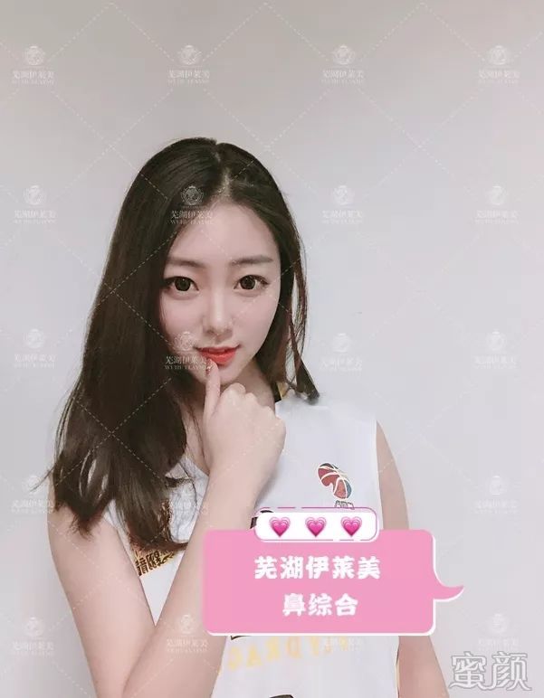 https://img.yiyiaimei.com/mnt/timg/200123/133K54H9-11.jpg