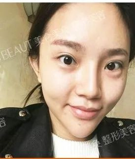 https://img.yiyiaimei.com/mnt/timg/200123/134HI0A-7.jpg