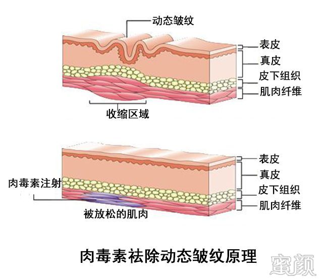 案例图片