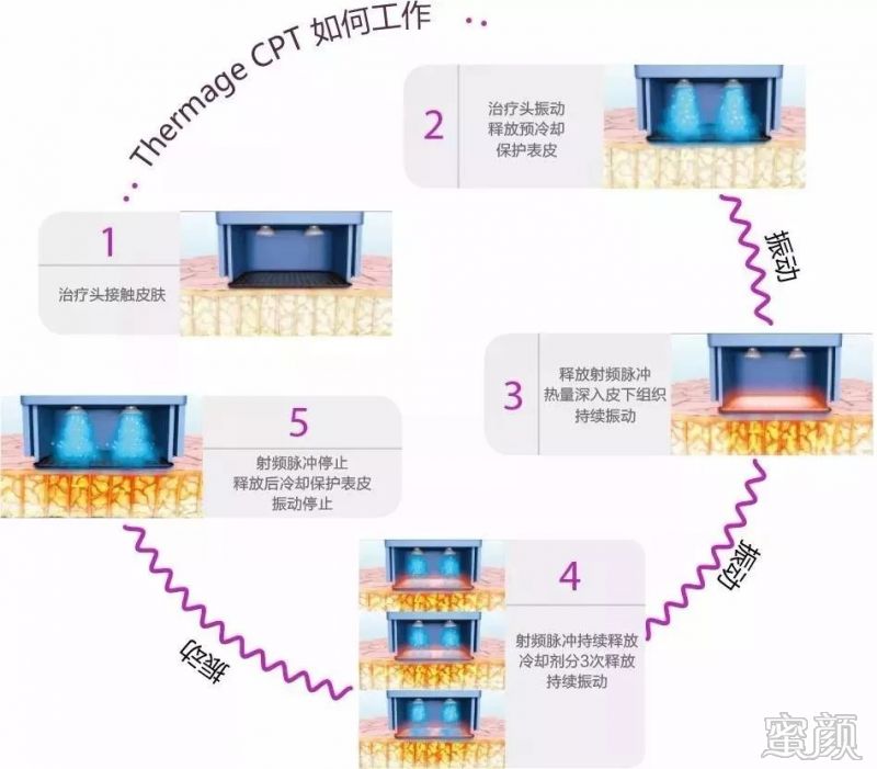 https://img.yiyiaimei.com/mnt/timg/200125/121T12055-3.jpg