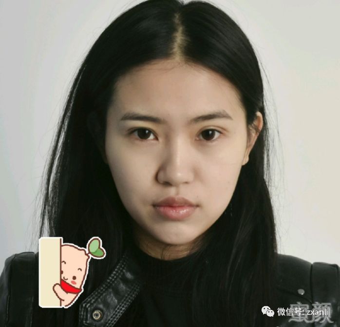 案例图片