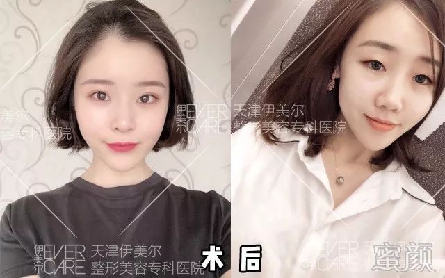 案例图片