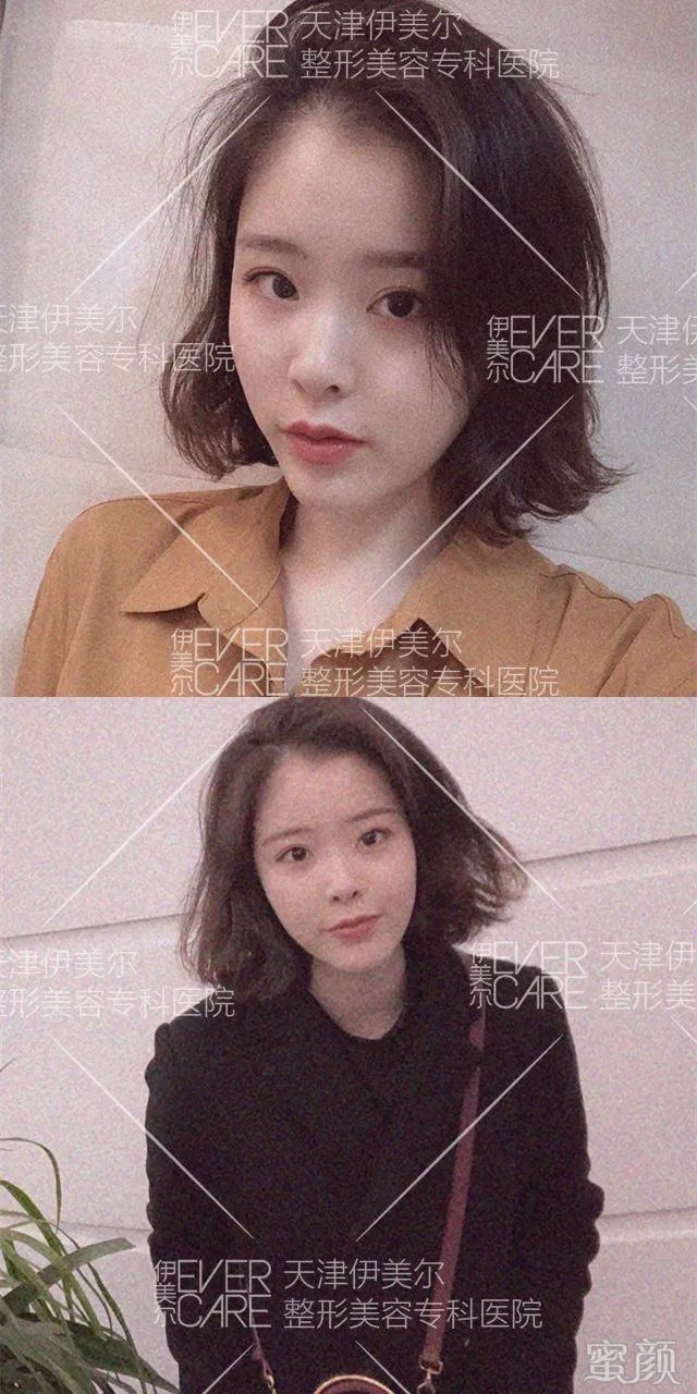 案例图片