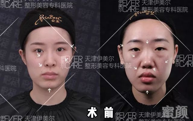 案例图片