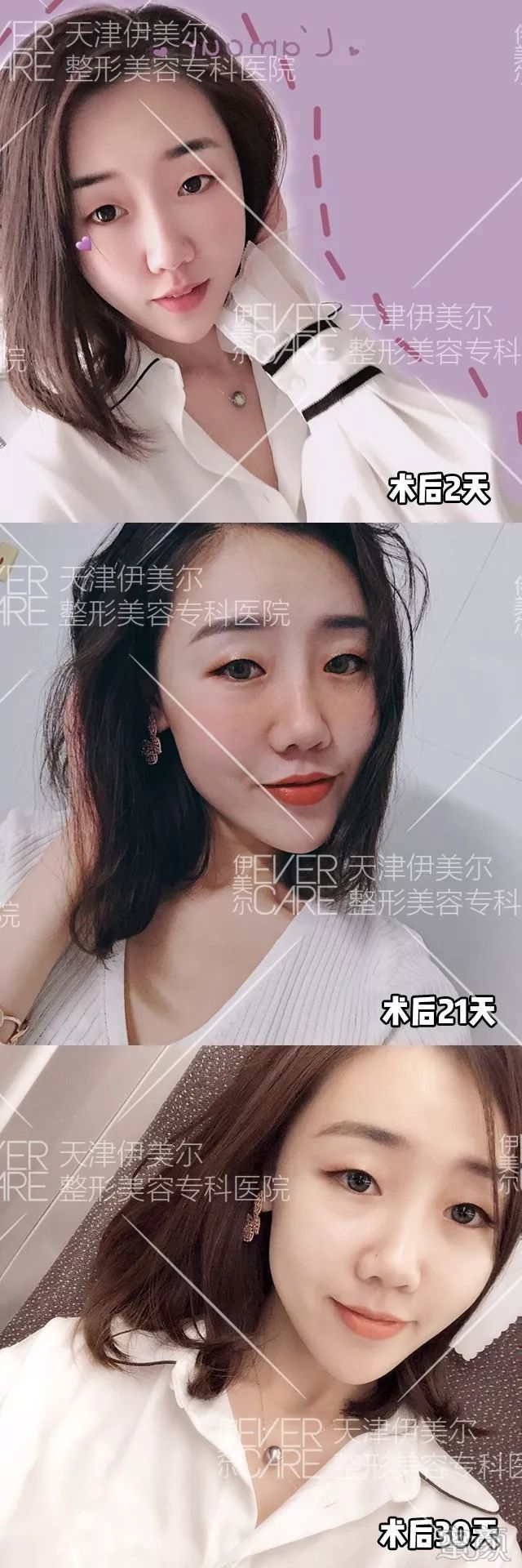 案例图片