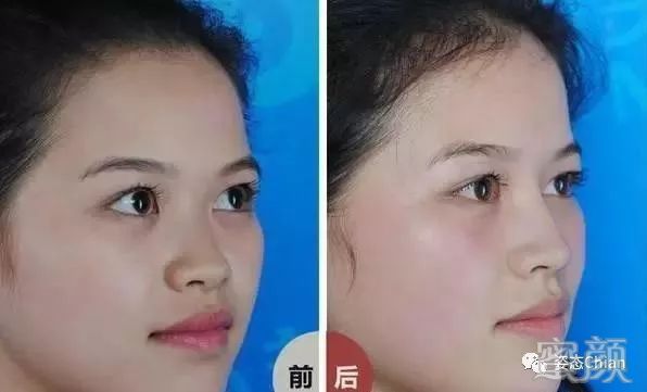 案例图片