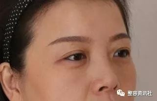 https://img.yiyiaimei.com/mnt/timg/200127/131S92018-0.jpg