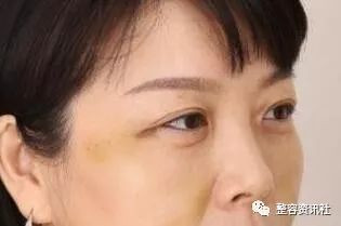 https://img.yiyiaimei.com/mnt/timg/200127/131S92K1-2.jpg