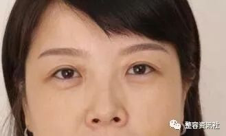 https://img.yiyiaimei.com/mnt/timg/200127/131T032R-3.jpg