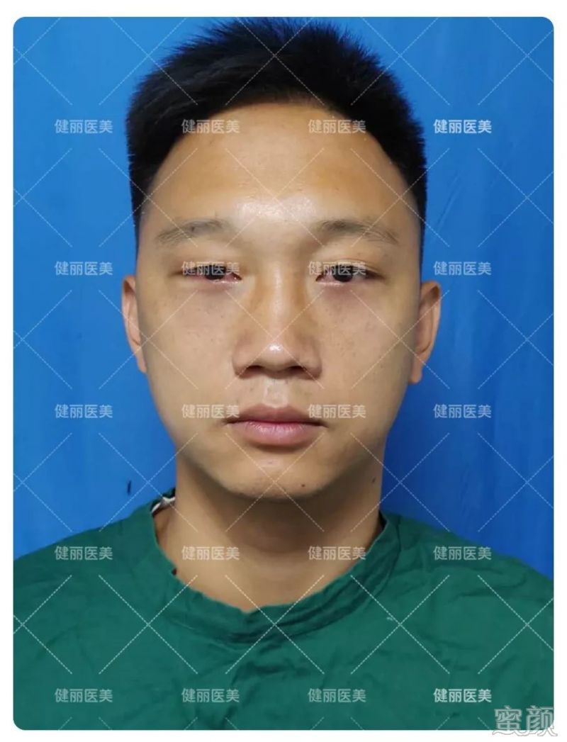 案例图片