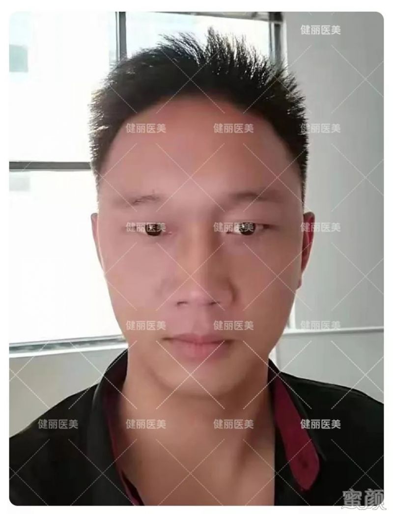案例图片