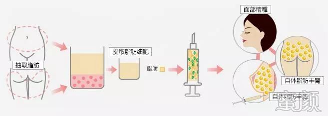 https://img.yiyiaimei.com/mnt/timg/200128/13444J258-4.jpg