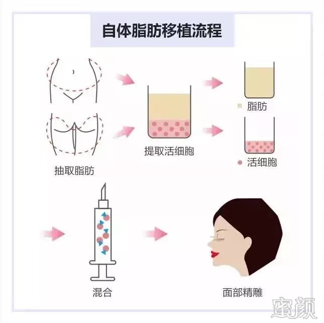 https://img.yiyiaimei.com/mnt/timg/200128/13444SK5-5.jpg