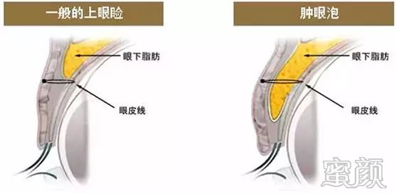 案例图片