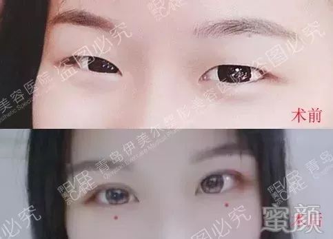 案例图片