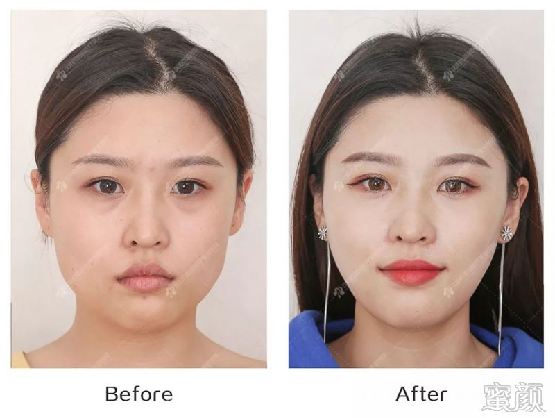 https://img.yiyiaimei.com/mnt/timg/200130/1323311D8-7.jpg