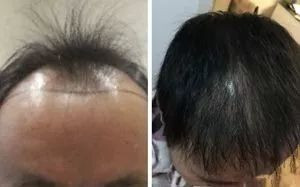 https://img.yiyiaimei.com/mnt/timg/200130/14045J3G-0.jpg