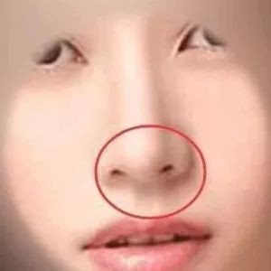 案例图片
