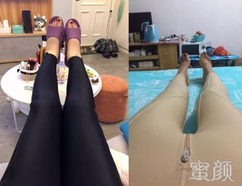 案例图片