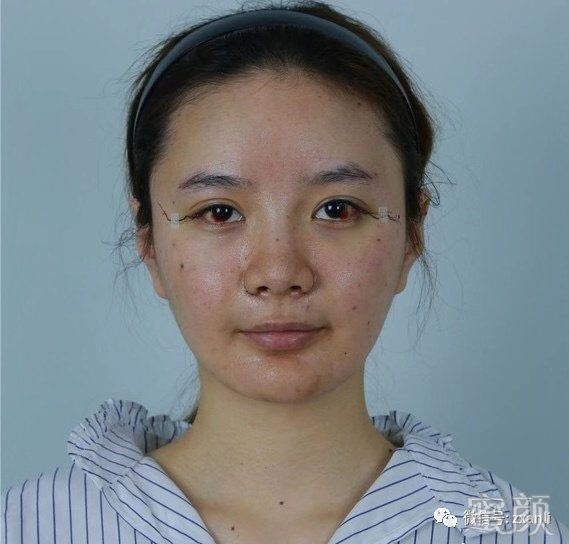 https://img.yiyiaimei.com/mnt/timg/200131/1311361939-0.jpg