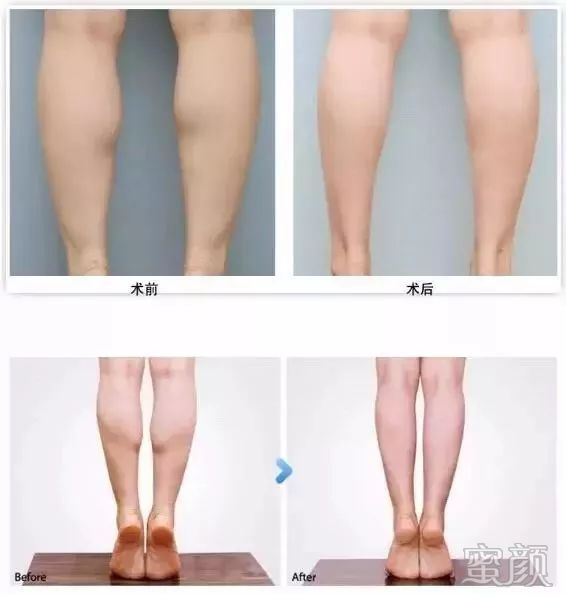 案例图片