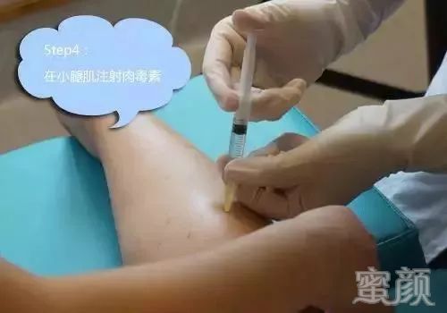 案例图片