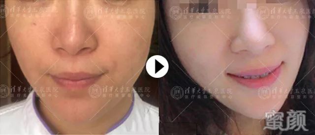 https://img.yiyiaimei.com/mnt/timg/200131/131H62Q0-2.jpg