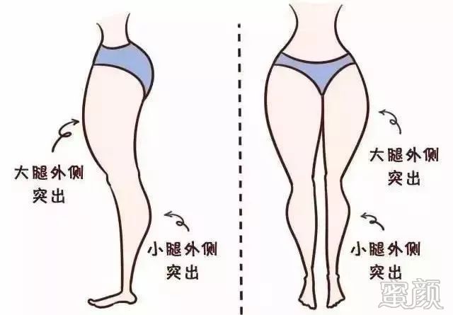 https://img.yiyiaimei.com/mnt/timg/200201/133P5D57-3.jpg 案例图片