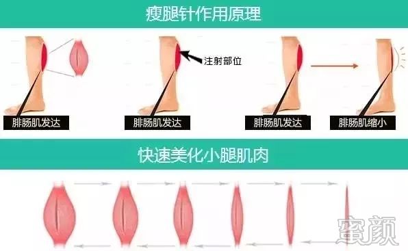 https://img.yiyiaimei.com/mnt/timg/200201/133Q13102-6.jpg 案例图片