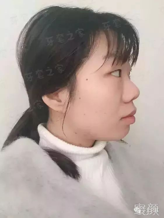 https://img.yiyiaimei.com/mnt/timg/200201/14252V3I-2.jpg 案例图片