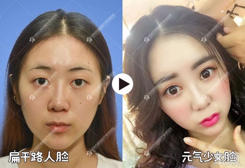 https://img.yiyiaimei.com/mnt/timg/200201/142PI5D-10.jpg