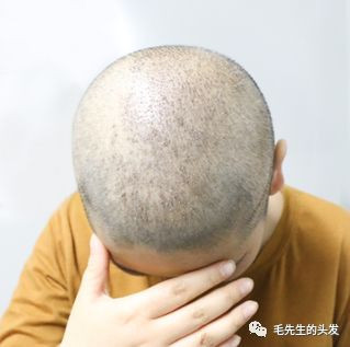 https://img.yiyiaimei.com/mnt/timg/200202/14202540W-2.jpg