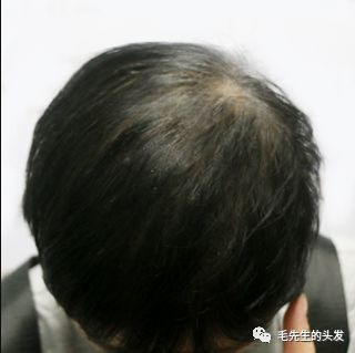 https://img.yiyiaimei.com/mnt/timg/200202/14202A643-6.jpg