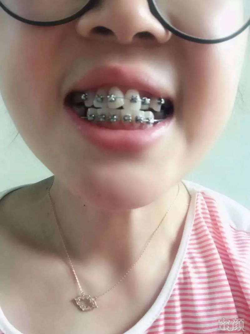 https://img.yiyiaimei.com/mnt/timg/200202/1450422Q3-6.jpg