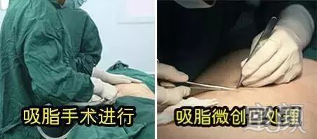 https://img.yiyiaimei.com/mnt/timg/200203/133G3KW-8.jpg 案例图片