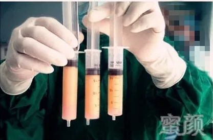 案例图片