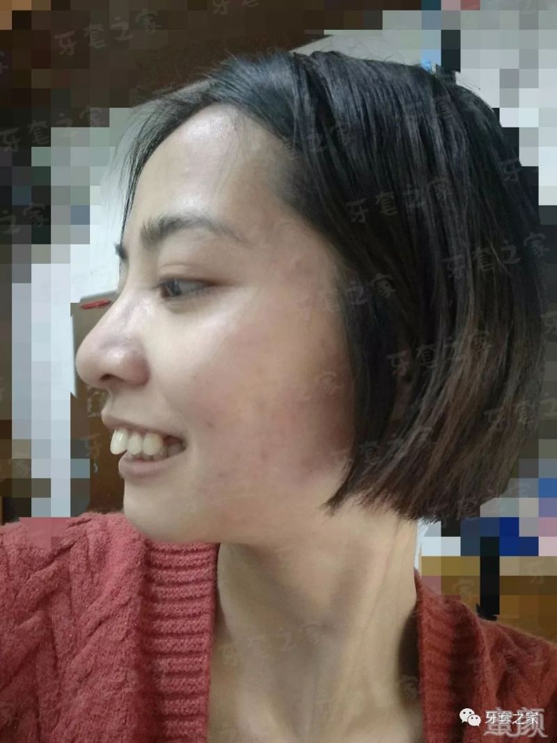 https://img.yiyiaimei.com/mnt/timg/200204/132440IU-3.jpg