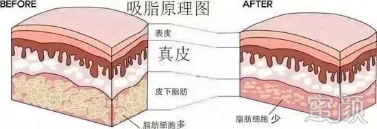 案例图片