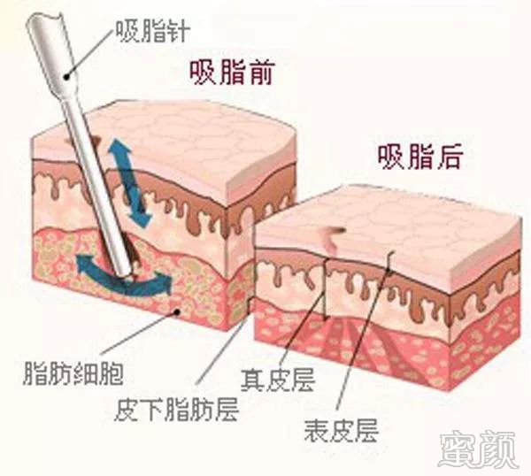 案例图片