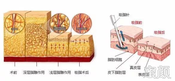 案例图片