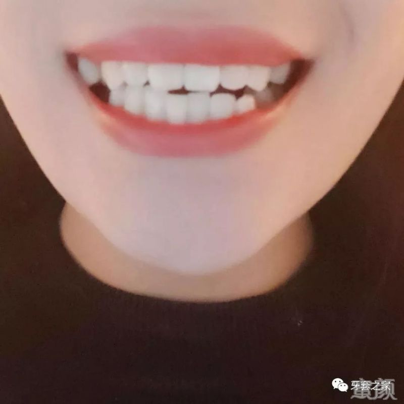 https://img.yiyiaimei.com/mnt/timg/200205/13292LM2-0.jpg