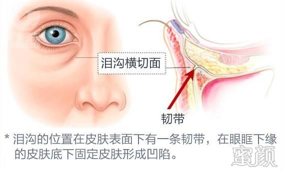 案例图片