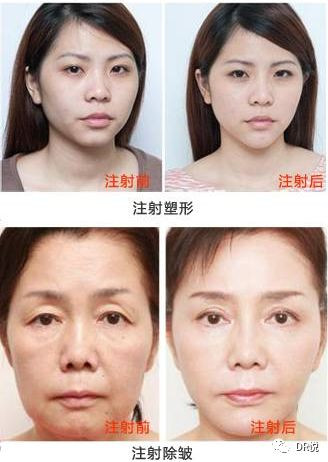 案例图片
