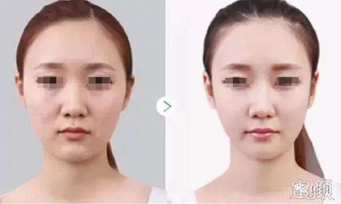 案例图片