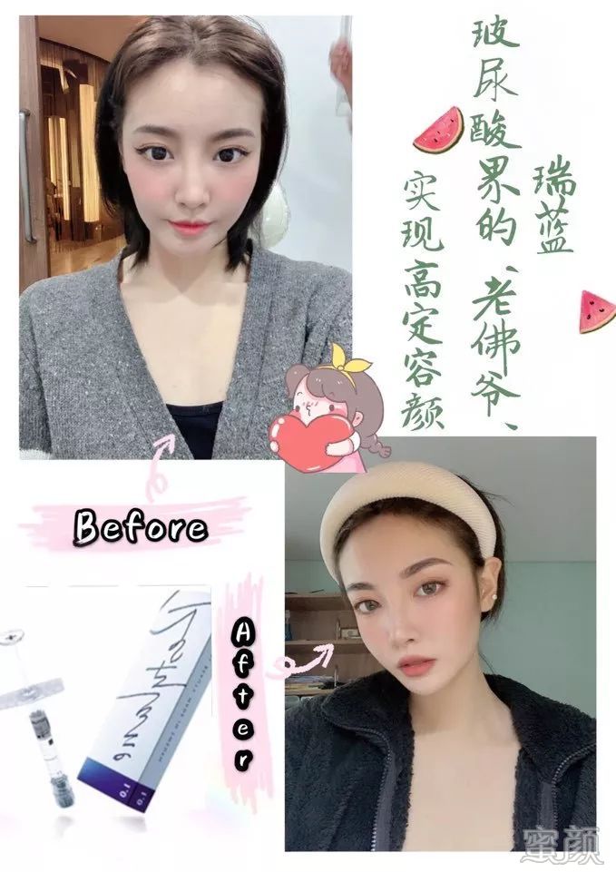https://img.yiyiaimei.com/mnt/timg/200206/132Z1A13-1.jpg