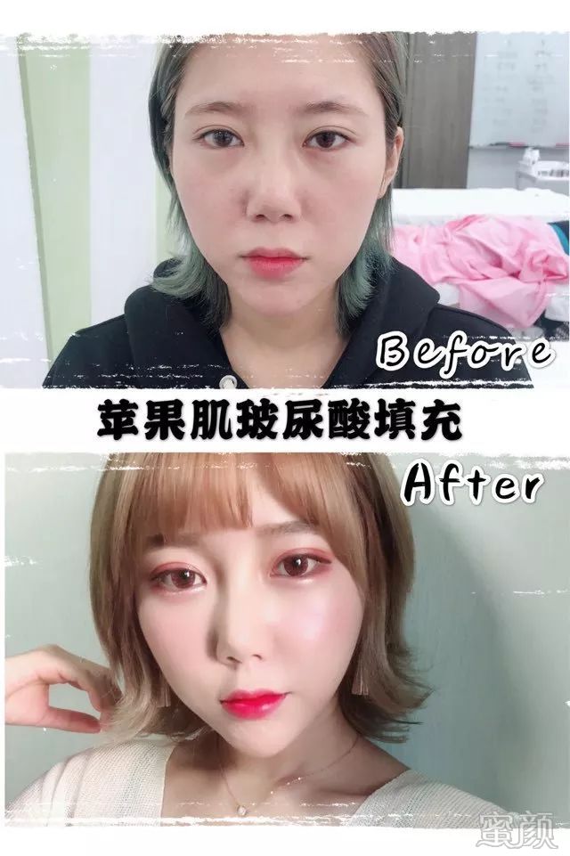 https://img.yiyiaimei.com/mnt/timg/200206/132Z52323-7.jpg