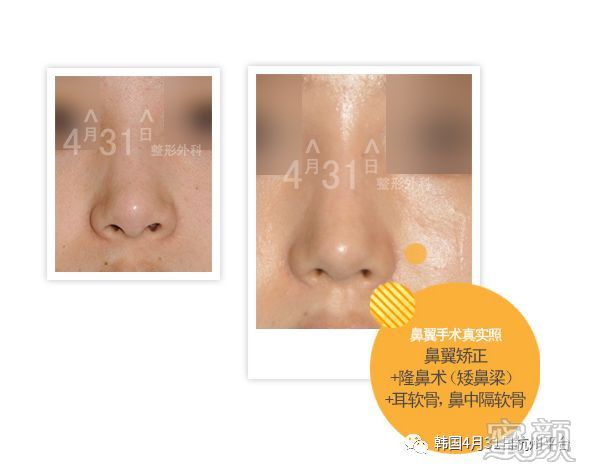 https://img.yiyiaimei.com/mnt/timg/200206/14055HJ9-7.jpg