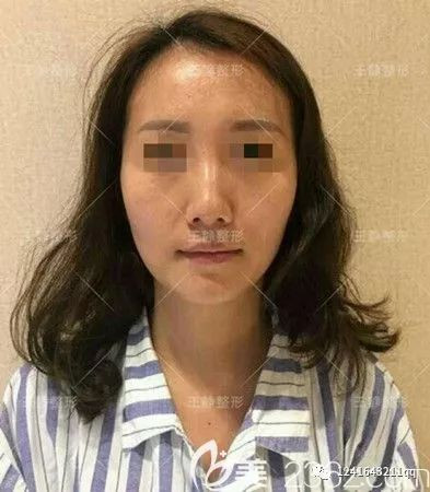 https://img.yiyiaimei.com/mnt/timg/200206/140631E19-0.jpg
