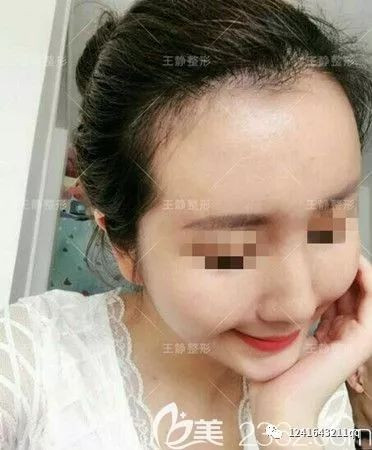 https://img.yiyiaimei.com/mnt/timg/200206/140631G60-2.jpg