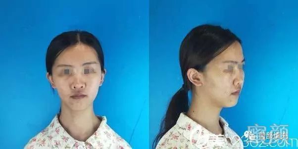 https://img.yiyiaimei.com/mnt/timg/200206/140RB050-0.jpg